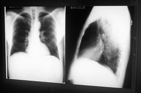 My X-rays. Click on this photo to see the larger ones.